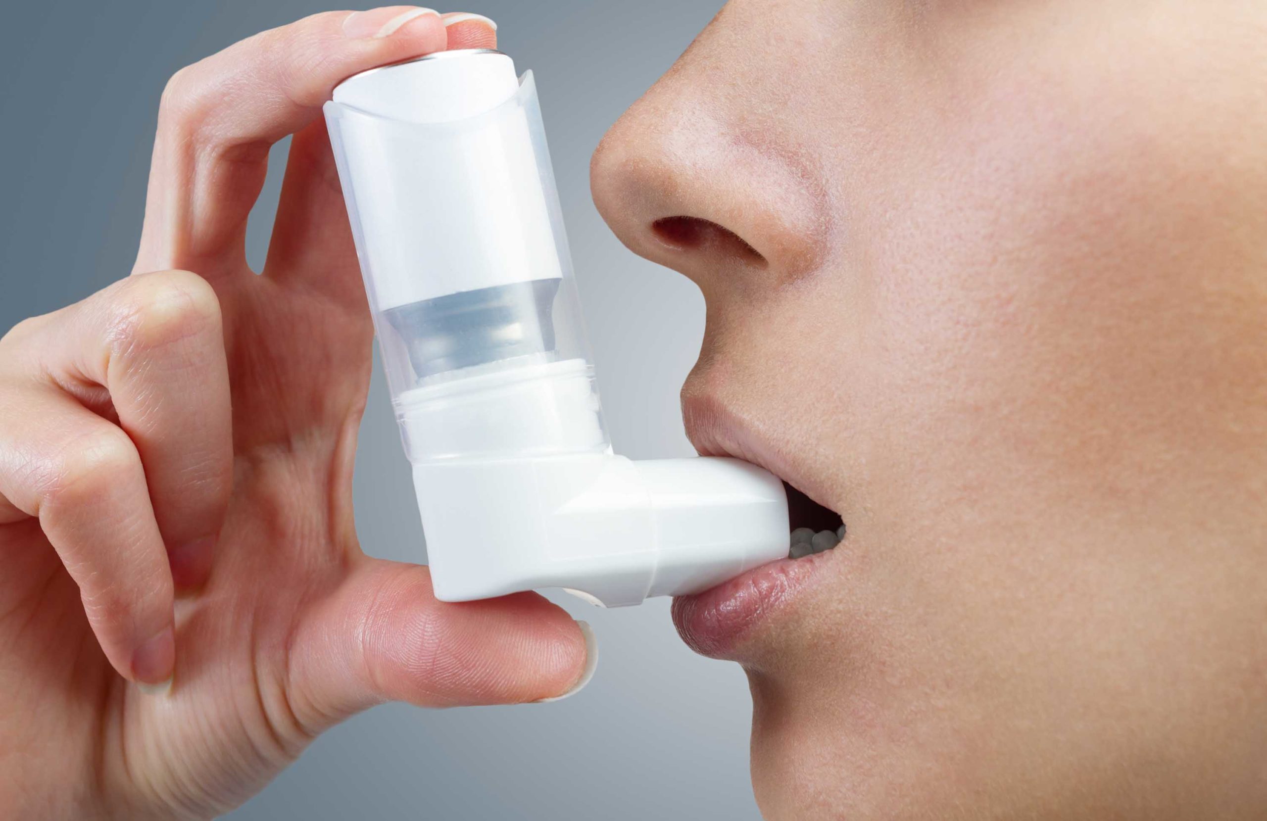 Treating Bronchial Asthma using Asthma Relief